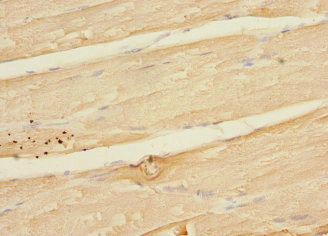 MAPKAPK3 Antibody - Immunohistochemistry of paraffin-embedded human skeletal muscle tissue at dilution 1:100