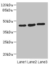 MAPKAPK3 Antibody - Western blot All Lanes: MAPKAPK3 antibody at 4.4ug/ml Lane 1: Hela whole cell lysate Lane 2: Jurkat whole cell lysate Lane 3: MCF7 whole cell lysate Secondary Goat polyclonal to Rabbit IgG at 1/10000 dilution Predicted band size: 43 kDa Observed band size: 43 kDa