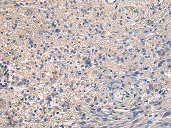 MAPKAPK3 Antibody - Immunohistochemistry of paraffin-embedded Human brain tissue  using MAPKAPK3 Polyclonal Antibody at dilution of 1:95(×200)