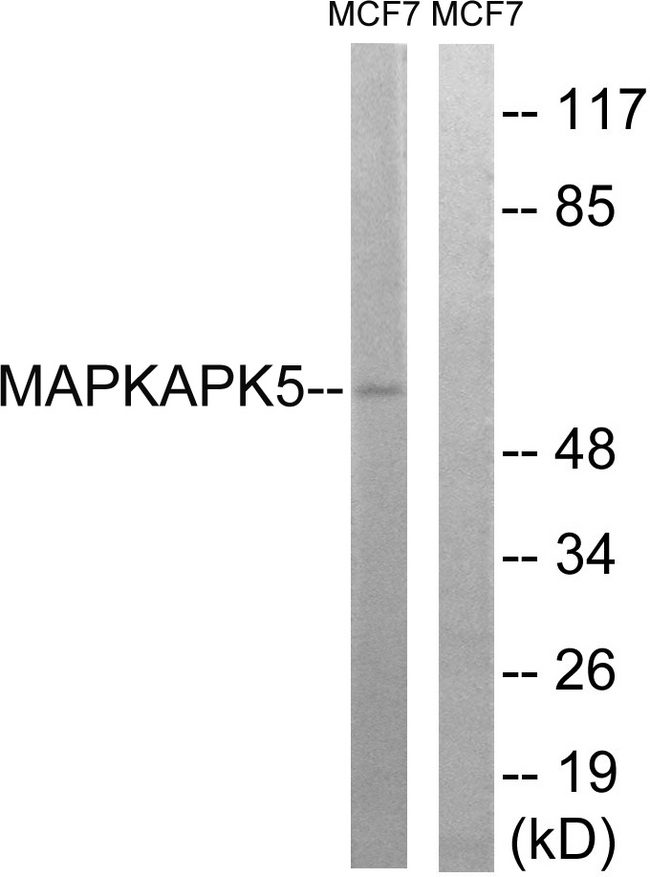 MAPKAPK5 / PRAK Antibody - Western blot analysis of lysates from MCF-7 cells, using MAPKAPK5 Antibody. The lane on the right is blocked with the synthesized peptide.