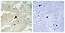 MAPKAPK5 / PRAK Antibody - Immunohistochemistry analysis of paraffin-embedded human brain tissue, using MAPKAPK5 Antibody. The picture on the right is blocked with the synthesized peptide.