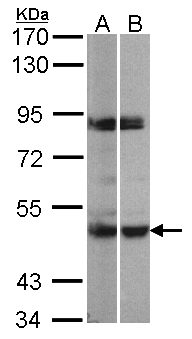 MAPKAPK5 / PRAK Antibody - Sample (30 ug of whole cell lysate). A:293T, B: H1299. 7.5% SDS PAGE. MAPKAPK5 / PRAK antibody diluted at 1:500