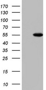 MAPKAPK5 / PRAK Antibody - HEK293T cells were transfected with the pCMV6-ENTRY control (Left lane) or pCMV6-ENTRY MAPKAPK5 (Right lane) cDNA for 48 hrs and lysed. Equivalent amounts of cell lysates (5 ug per lane) were separated by SDS-PAGE and immunoblotted with anti-MAPKAPK5.