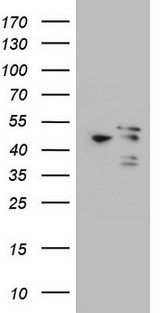 MAPKAPK5 / PRAK Antibody - HEK293T cells were transfected with the pCMV6-ENTRY control (Left lane) or pCMV6-ENTRY MAPKAPK5 (Right lane) cDNA for 48 hrs and lysed. Equivalent amounts of cell lysates (5 ug per lane) were separated by SDS-PAGE and immunoblotted with anti-MAPKAPK5.