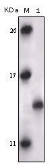 MAPKAPK5 / PRAK Antibody - Western blot using PRAK mouse monoclonal antibody against truncated PRAK recombinant protein.