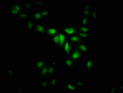 MAPKAPK5 / PRAK Antibody - Immunofluorescence staining of Hela cells with MAPKAPK5 Antibody at 1:266, counter-stained with DAPI. The cells were fixed in 4% formaldehyde, permeabilized using 0.2% Triton X-100 and blocked in 10% normal Goat Serum. The cells were then incubated with the antibody overnight at 4°C. The secondary antibody was Alexa Fluor 488-congugated AffiniPure Goat Anti-Rabbit IgG(H+L).
