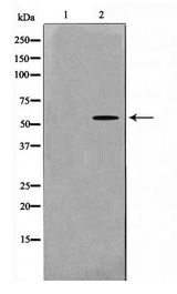 MAPKAPK5 / PRAK Antibody - Western blot of K562 cell lysate using MAPKAPK5 Antibody