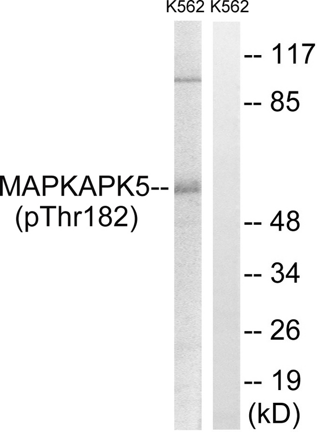 MAPKAPK5 / PRAK Antibody - Western blot analysis of lysates from K562 cells treated with Na3VO4 0.3nM 40', using MAPKAPK5 (Phospho-Thr182) Antibody. The lane on the right is blocked with the phospho peptide.