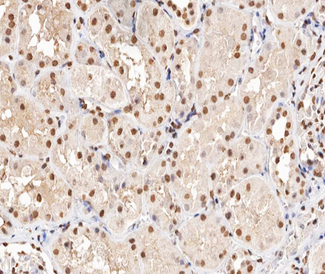 MAPKAPK5 / PRAK Antibody - 1:200 staining human kidney tissue by IHC-P. The tissue was formaldehyde fixed and a heat mediated antigen retrieval step in citrate buffer was performed. The tissue was then blocked and incubated with the antibody for 1.5 hours at 22°C. An HRP conjugated goat anti-rabbit antibody was used as the secondary.