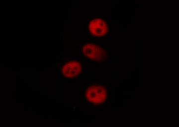 MAPKAPK5 / PRAK Antibody - Staining K562 cells by IF/ICC. The samples were fixed with PFA and permeabilized in 0.1% Triton X-100, then blocked in 10% serum for 45 min at 25°C. The primary antibody was diluted at 1:200 and incubated with the sample for 1 hour at 37°C. An Alexa Fluor 594 conjugated goat anti-rabbit IgG (H+L) Ab, diluted at 1/600, was used as the secondary antibody.