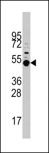 MAPKAPK5 / PRAK Antibody - Western blot of MAPKAPK5 Antibody (T182) in HeLa cell line lysates (35 ug/lane). MAPKAPK5 (arrow) was detected using the purified antibody.