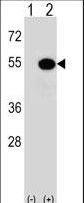 MAPKAPK5 / PRAK Antibody - Western blot of MAPKAPK5 (arrow) using rabbit polyclonal MAPKAPK5 Antibody (T182). 293 cell lysates (2 ug/lane) either nontransfected (Lane 1) or transiently transfected (Lane 2) with the MAPKAPK5 gene.
