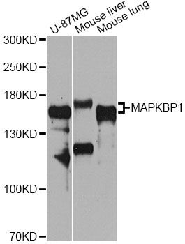 MAPKBP1 Antibody - Western blot analysis of extracts of various cell lines, using MAPKBP1 antibody at 1:1000 dilution. The secondary antibody used was an HRP Goat Anti-Rabbit IgG (H+L) at 1:10000 dilution. Lysates were loaded 25ug per lane and 3% nonfat dry milk in TBST was used for blocking. An ECL Kit was used for detection and the exposure time was 90s.