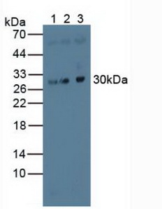 MAPRE1 / EB1 Antibody - Western Blot; Sample: Lane1: Human Hela Cells; Lane2: Human Jurkat Cells; Lane3: Porcine Brain Tissue.