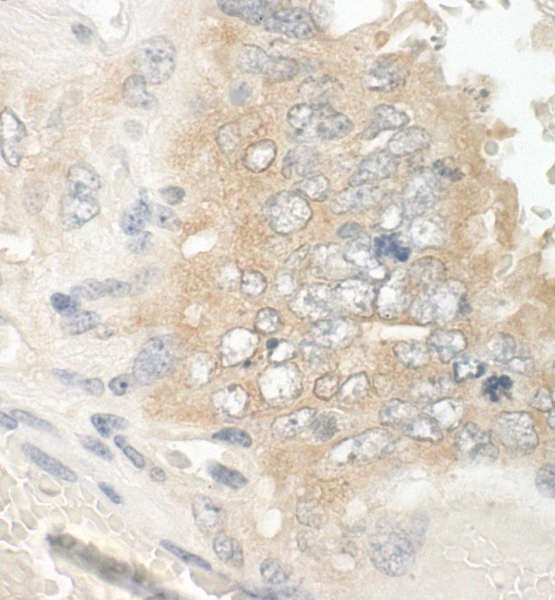 MAPRE1 / EB1 Antibody - Detection of Mouse EB1 by Immunohistochemistry. Sample: FFPE section of mouse teratoma. Antibody: Affinity purified rabbit anti-EB1 used at a dilution of 1:250.