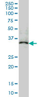 MAPRE2 / EB2 Antibody - MAPRE2 monoclonal antibody (M03), clone 4D7 Western blot of MAPRE2 expression in K-562.