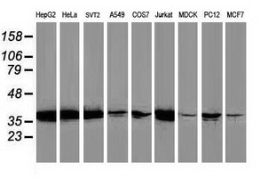 MAPRE2 / EB2 Antibody - Western blot of extracts (35ug) from 9 different cell lines by using anti-MAPRE2 monoclonal antibody.