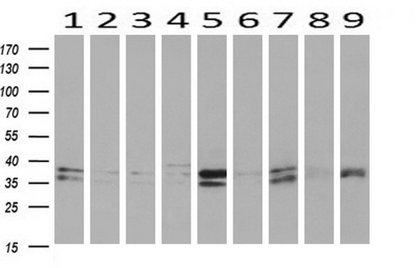 MAPRE2 / EB2 Antibody - Western blot of extracts (10ug) from 9 Human tissue by using anti-MAPRE2 monoclonal antibody at 1:200 (1: Testis; 2: Omentum; 3: Uterus; 4: Breast; 5: Brain; 6: Liver; 7: Ovary; 8: Thyroid gland; 9: colon).