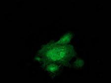 MAPRE2 / EB2 Antibody - Anti-MAPRE2 mouse monoclonal antibody immunofluorescent staining of COS7 cells transiently transfected by pCMV6-ENTRY MAPRE2.