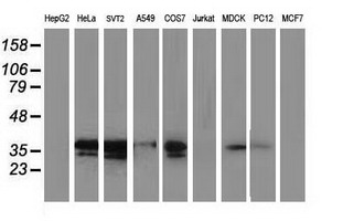 MAPRE2 / EB2 Antibody - Western blot of extracts (35 ug) from 9 different cell lines by using anti-MAPRE2 monoclonal antibody.