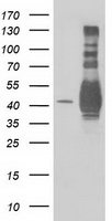 MAPRE2 / EB2 Antibody - HEK293T cells were transfected with the pCMV6-ENTRY control (Left lane) or pCMV6-ENTRY MAPRE2 (Right lane) cDNA for 48 hrs and lysed. Equivalent amounts of cell lysates (5 ug per lane) were separated by SDS-PAGE and immunoblotted with anti-MAPRE2.