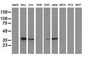 MAPRE2 / EB2 Antibody - Western blot of extracts (35ug) from 9 different cell lines by using anti-MAPRE2 monoclonal antibody.