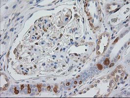 MAPRE2 / EB2 Antibody - IHC of paraffin-embedded Human Kidney tissue using anti-MAPRE2 mouse monoclonal antibody.