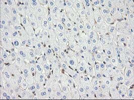 MAPRE2 / EB2 Antibody - IHC of paraffin-embedded Human liver tissue using anti-MAPRE2 mouse monoclonal antibody.