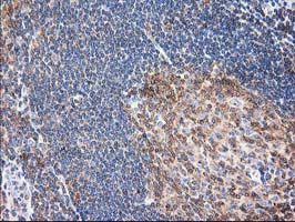 MAPRE2 / EB2 Antibody - IHC of paraffin-embedded Human lymph node tissue using anti-MAPRE2 mouse monoclonal antibody.