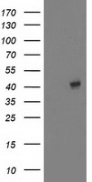 MAPRE2 / EB2 Antibody - HEK293T cells were transfected with the pCMV6-ENTRY control (Left lane) or pCMV6-ENTRY MAPRE2 (Right lane) cDNA for 48 hrs and lysed. Equivalent amounts of cell lysates (5 ug per lane) were separated by SDS-PAGE and immunoblotted with anti-MAPRE2.