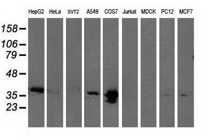 MAPRE2 / EB2 Antibody - Western blot of extracts (35 ug) from 9 different cell lines by using anti-MAPRE2 monoclonal antibody (HepG2: human; HeLa: human; SVT2: mouse; A549: human; COS7: monkey; Jurkat: human; MDCK: canine; PC12: rat; MCF7: human).