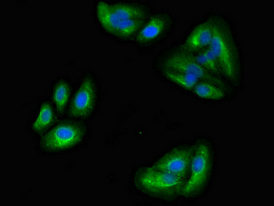 MAPRE2 / EB2 Antibody - Immunofluorescent analysis of HepG2 cells diluted at 1:100 and Alexa Fluor 488-congugated AffiniPure Goat Anti-Rabbit IgG(H+L)