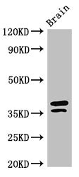 MAPRE2 / EB2 Antibody - Western Blot Positive WB detected in:Mouse brain tissue All Lanes:MAPRE2 antibody at 3µg/ml Secondary Goat polyclonal to rabbit IgG at 1/50000 dilution Predicted band size: 38,30,36,33,31 KDa Observed band size: 38,36 KDa