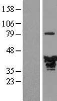 MAPRE2 / EB2 Protein - Western validation with an anti-DDK antibody * L: Control HEK293 lysate R: Over-expression lysate