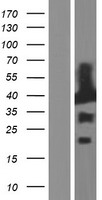 MAPRE2 / EB2 Protein - Western validation with an anti-DDK antibody * L: Control HEK293 lysate R: Over-expression lysate