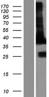 MAPRE2 / EB2 Protein - Western validation with an anti-DDK antibody * L: Control HEK293 lysate R: Over-expression lysate