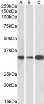 MAPRE3 / EB3 Antibody - Goat Anti-MAPRE3 (aa151-164) Antibody (0.1?/ml) staining of Human (A), Mouse (B) and Rat (C) Brain lysate (35? protein in RIPA buffer). Primary incubation was 1 hour. Detected by chemiluminescence.