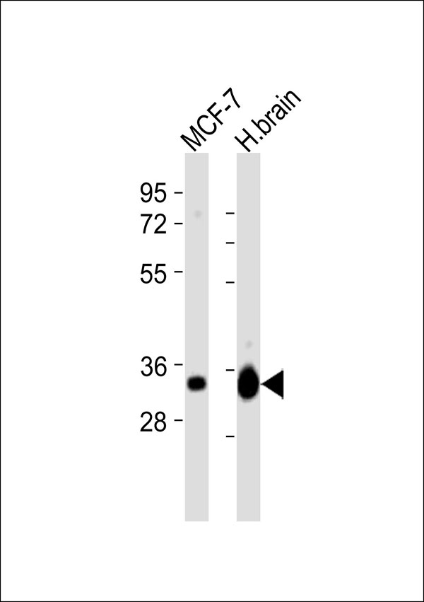 MAPRE3 / EB3 Antibody - All lanes : Anti-EB3 Antibody at 1:8000 dilution Lane 1: MCF-7 whole cell lysates Lane 2: human brain lysates Lysates/proteins at 20 ug per lane. Secondary Goat Anti-Rabbit IgG, (H+L),Peroxidase conjugated at 1/10000 dilution Predicted band size : 32 kDa Blocking/Dilution buffer: 5% NFDM/TBST.