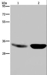 MAPRE3 / EB3 Antibody - Western blot analysis of Human fetal brain and mouse brain tissue, using MAPRE3 Polyclonal Antibody at dilution of 1:500.