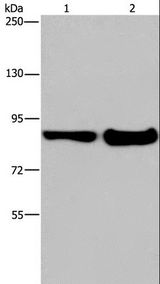 MAPRE3 / EB3 Antibody - Western blot analysis of Mouse lung and liver tissue, using ECE1 Polyclonal Antibody at dilution of 1:1050.