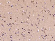 MAPRE3 / EB3 Antibody - Immunochemical staining of human MAPRE3 in human brain with rabbit polyclonal antibody at 1:100 dilution, formalin-fixed paraffin embedded sections.