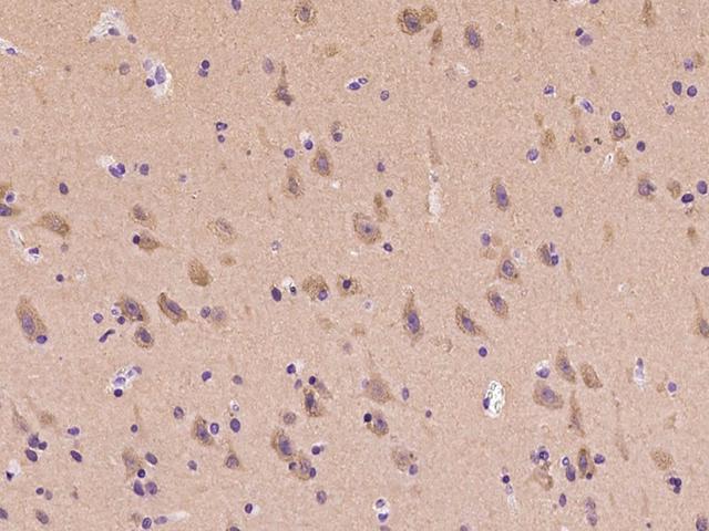 MAPRE3 / EB3 Antibody - Immunochemical staining of human MAPRE3 in human brain with rabbit polyclonal antibody at 1:100 dilution, formalin-fixed paraffin embedded sections.
