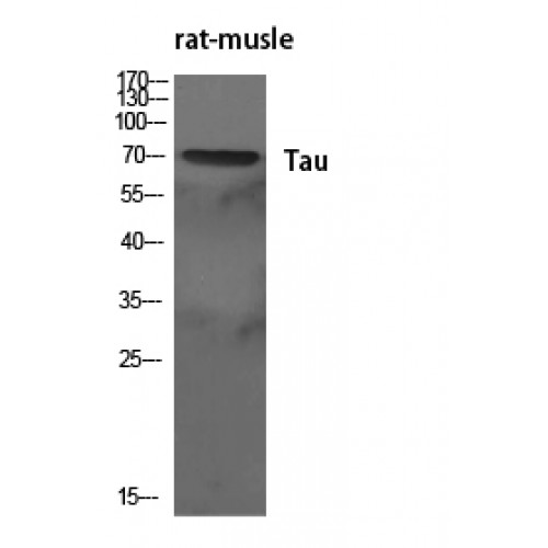 MAPT / Tau Antibody - Western blot of Tau antibody