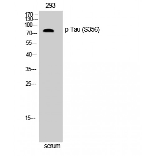 MAPT / Tau Antibody - Western blot of Phospho-Tau (S356) antibody