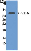 MAPT / Tau Antibody - Western Blot; Sample: Recombinant MAPt, Human.