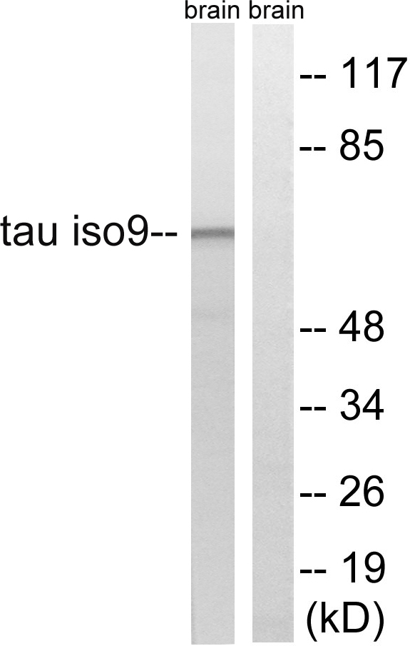 MAPT / Tau Antibody - Western blot analysis of lysates from rat brain cells, using Tau Antibody. The lane on the right is blocked with the synthesized peptide.