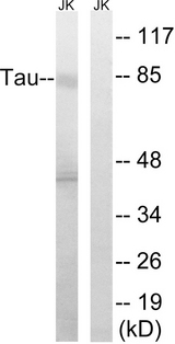 MAPT / Tau Antibody - Western blot analysis of lysates from Jurkat cells, using Tau Antibody. The lane on the right is blocked with the synthesized peptide.