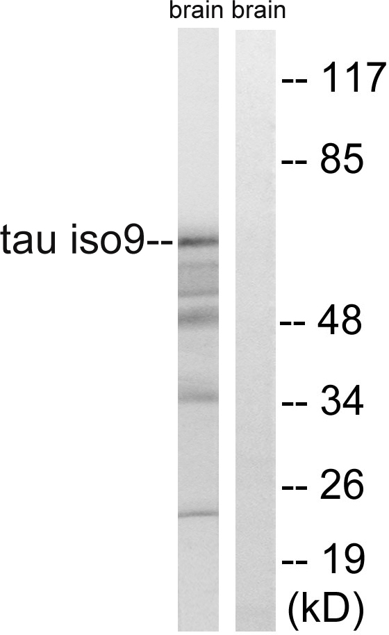 MAPT / Tau Antibody - Western blot analysis of lysates from rat brain, using Tau Antibody. The lane on the right is blocked with the synthesized peptide.