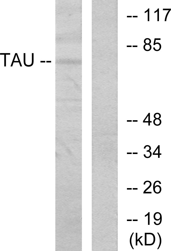 MAPT / Tau Antibody - Western blot analysis of lysates from MDA-MB-435 cells, using Tau Antibody. The lane on the right is blocked with the synthesized peptide.