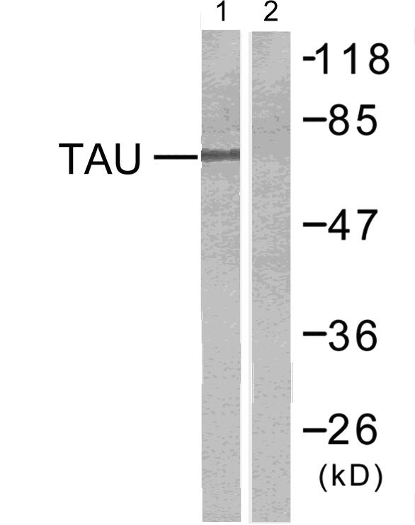 MAPT / Tau Antibody - Western blot analysis of lysates from mouse brain, using Tau Antibody. The lane on the right is blocked with the synthesized peptide.